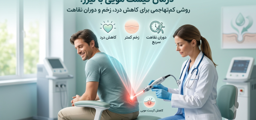 درمان کیست مویی با لیزر؛ روشی کم‌تهاجمی برای کاهش درد، زخم و دوران نقاهت